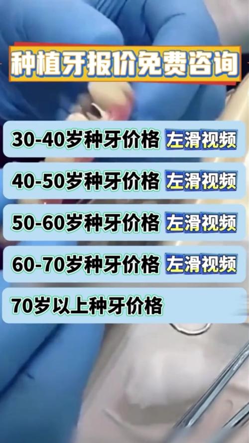 杭州南充半口种牙到底要花多少钱？2026年真实报价揭秘