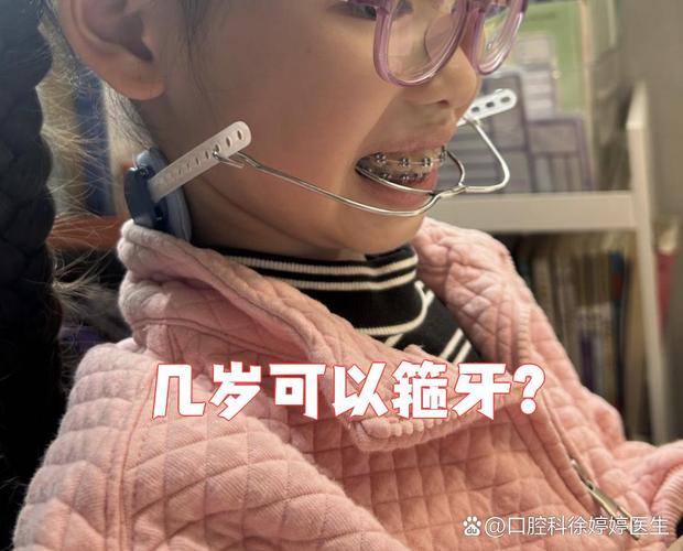 杭州11岁孩子牙齿矫正，到底合不合适？