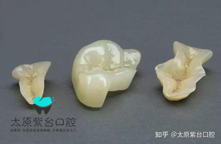 杭州口腔检查反馈单看不懂？3步教你秒读