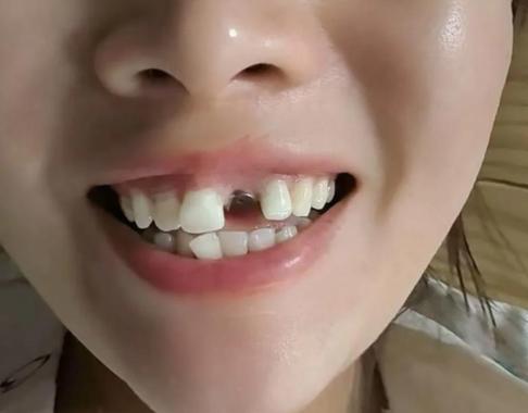 杭州看牙能网上问医生吗？口腔在线解答到底靠不靠谱