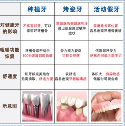 杭州赤峰种牙别乱选 公立三甲医院才靠谱
