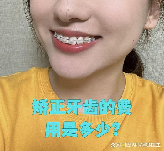 杭州纠正牙型费用全解析：矫正牙齿一般要多少钱