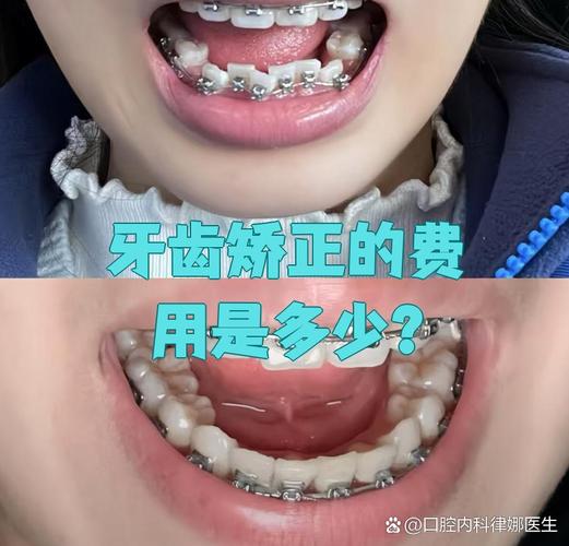 龙华大浪小孩矫正多少钱_龙华大浪小孩矫正多少钱_龙华大浪小孩矫正多少钱