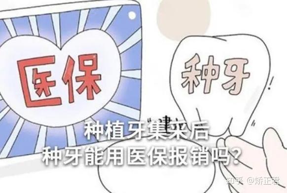 杭州深圳种植牙医保报销政策最新解读