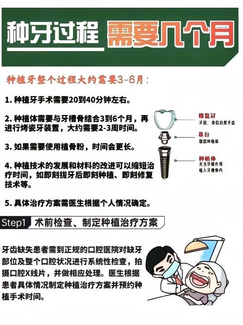 杭州半口种植牙能用多久？医生技术好能管20年