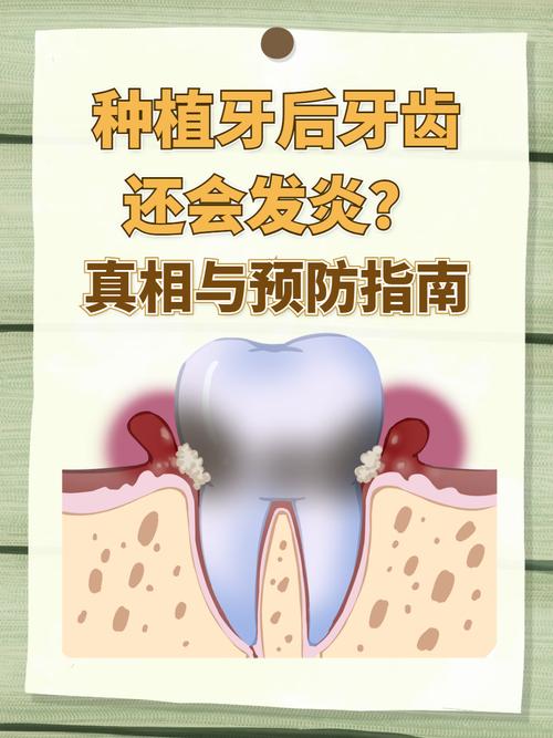 杭州种植牙严重松动发炎，什么情况需要拔除？