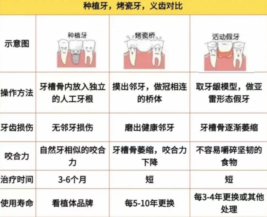 杭州2万块种牙到底够不够 真实费用全解析
