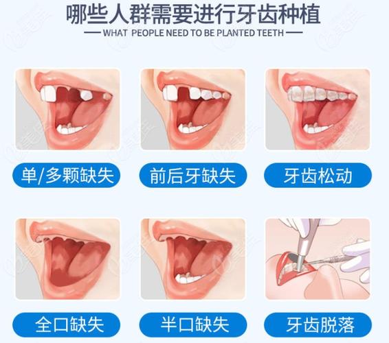 杭州保定口腔医院收费多少钱？看牙项目全解析