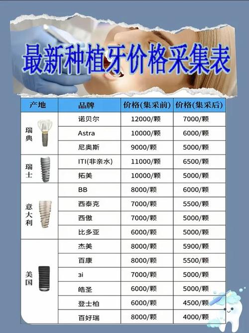 杭州半口种植牙多少钱？3万起还是10万起？看品牌和骨量
