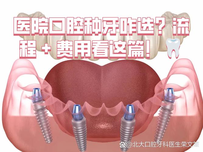 杭州深圳连锁牙科种牙贵不贵？值不值得选？