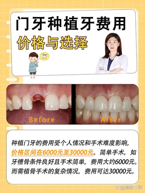 门牙掉了后能装假牙还是种牙_门牙掉了可以种牙吗_门牙掉了可以种吗