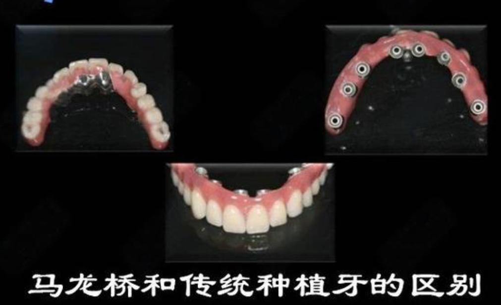 杭州大同种牙哪里好 选公立还是私立更靠谱