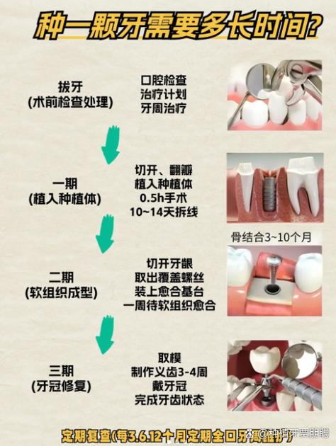杭州种牙前做CT是必须的吗 2026种牙CT检查费用全解析