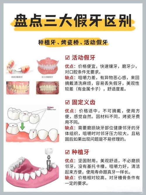 杭州牙齿掉了是种牙还是镶牙 种牙过程和价格一文说清