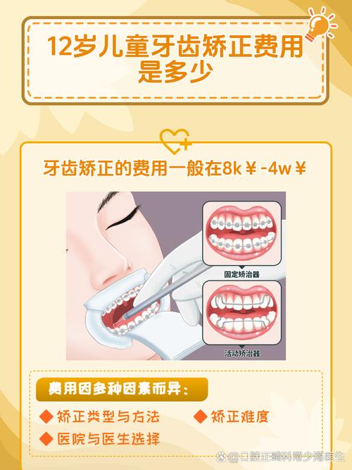 杭州12岁矫正牙齿要多少钱？医生揭秘各阶段费用明细
