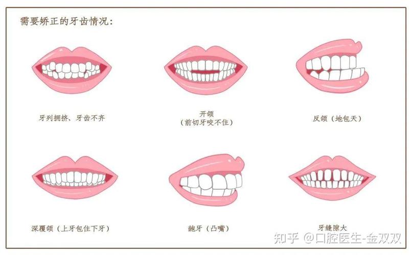 成年牙齿矫正后保持器要戴多久_成年后牙齿可以矫正吗_成年牙齿矫正可以后改善吗