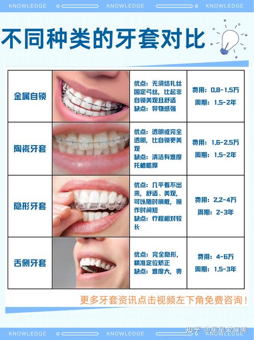 杭州一颗牙矫正要花多少钱？别再被“一口价”忽悠了，费用明细全在这