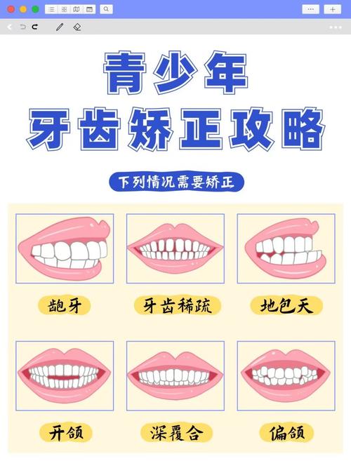 杭州15岁牙齿不齐别慌！抓住矫正黄金期，这些方法快收藏