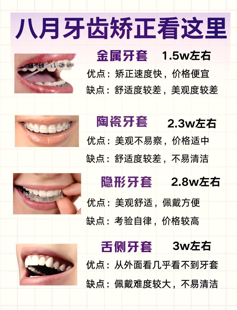 杭州门牙突出矫正费用全解析 看完这篇不再被坑