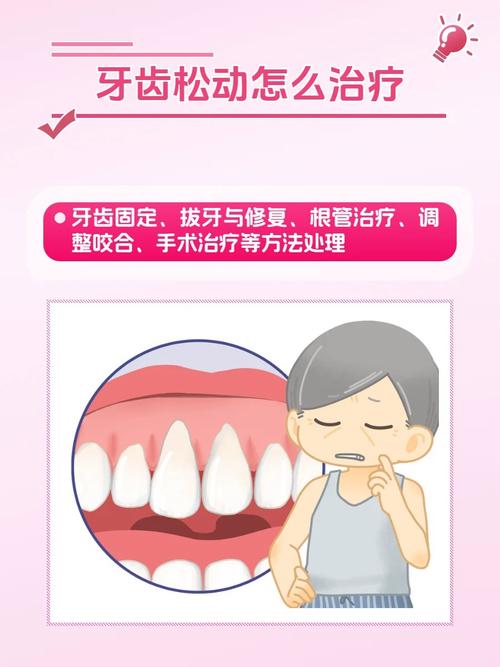杭州牙齿松动能即拔即种吗 医生说出3个关键条件