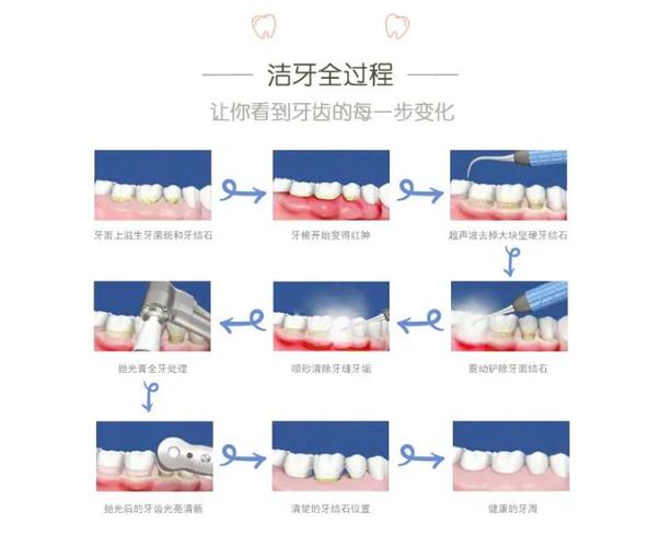 杭州深圳宝安隐适美正品认证医院怎么选？