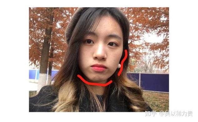 杭州莲塘小孩正畸多少钱？费用明细和避坑指南