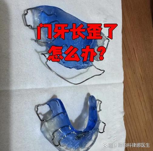 杭州牙齿长歪了怎么矫正?多少钱能搞定?