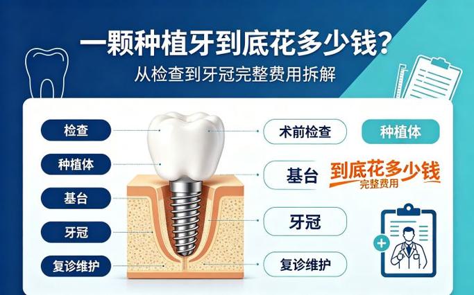 杭州去口腔医院种一颗牙得花多少钱?详细拆解告诉你