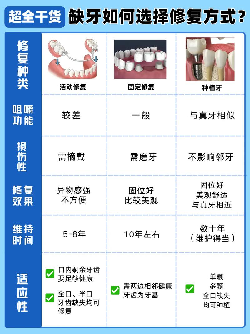 杭州补牙种牙镶牙怎么选？牙医一次说清楚