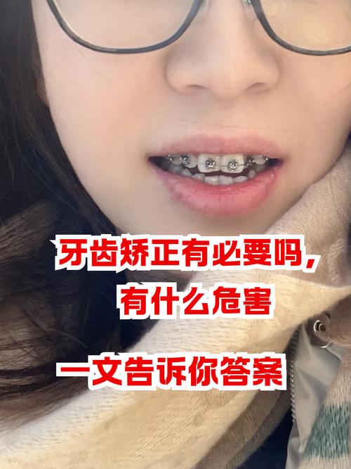 杭州35岁隐形矫正晚不晚 成人正畸的真相与关键