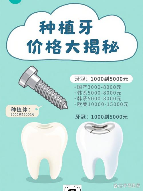 杭州奥齿泰种牙贵不贵？一颗的价格究竟是多少？看完这篇就知道！