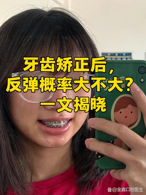 杭州19岁做牙齿矫正晚不晚 过来人告诉你真实经历