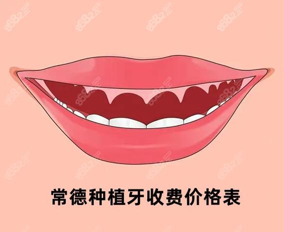 杭州常德半口种植牙费用2026大概多少钱？真实价格参考
